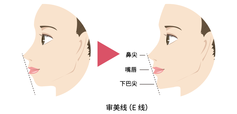 エステティックライン（Eライン）