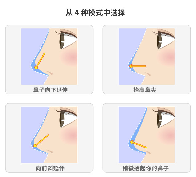 4パターンからお選びいただけます