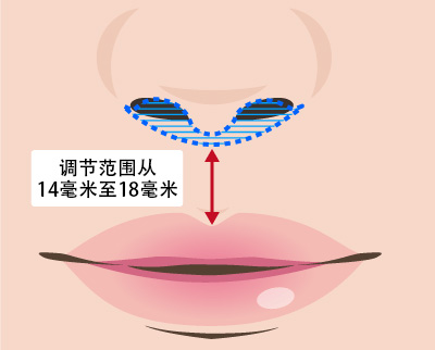 人中短縮術の方法