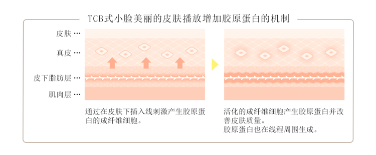 TCB式小顔美肌再生によるコラーゲン生成のメカニズム