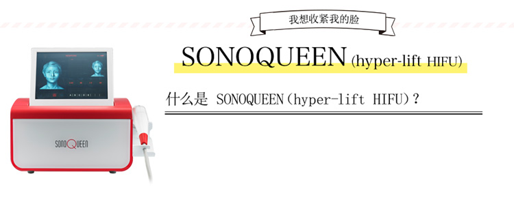 SONOQUEEN（HIFU）とは